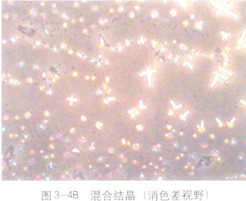 miꎵDV——miճҺ}YcϽY